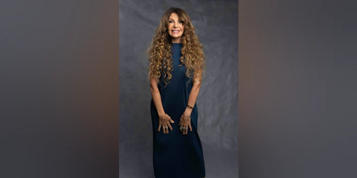 Elba Ramalho